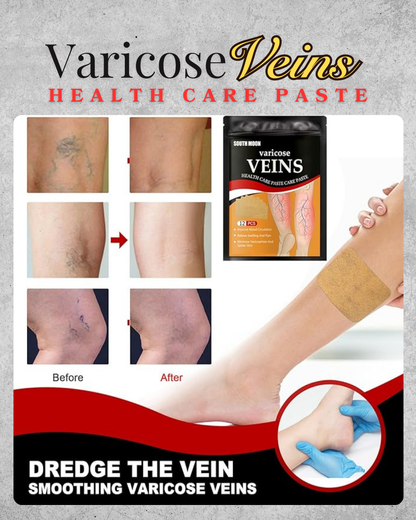 DocOng Effective Varicose Veins Health Care Paste 12pcs 24pcs 36pcs 48pcs