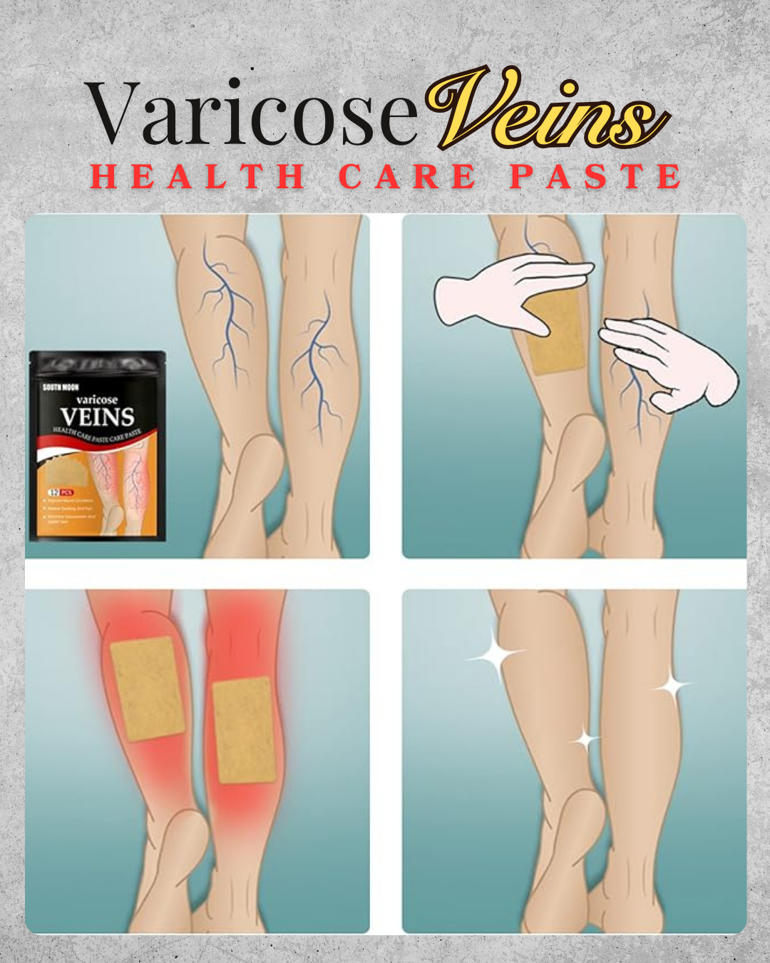 DocOng Effective Varicose Veins Health Care Paste 12pcs 24pcs 36pcs 48pcs