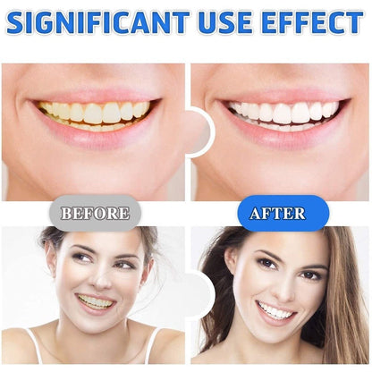 5D WHITE Teeth Whitening Strips